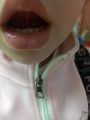 Вызов речи у детей от 2-х лет, постановка и коррекция звукопроизношения
